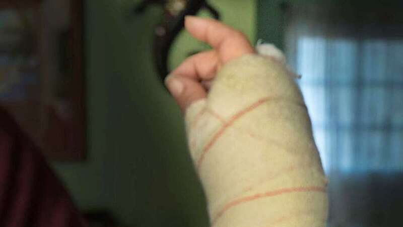 Mano derecha de la mujer asaltada/TA.